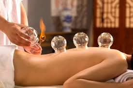 Cups are placed on the skin to create suction during cupping therapy.